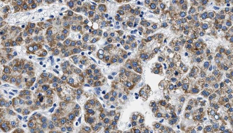 Polyclonal Rabbit anti-Human NPY5R Antibody (IHC, IF, WB)