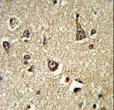 PHGDH Antibody (aa140-168)