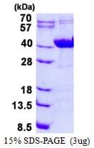Human NDUFAF1 / CIA30 Protein (Recombinant His)