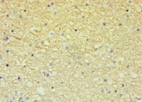 Polyclonal Rabbit anti-Human ECE2 Antibody (aa1-160, IHC)