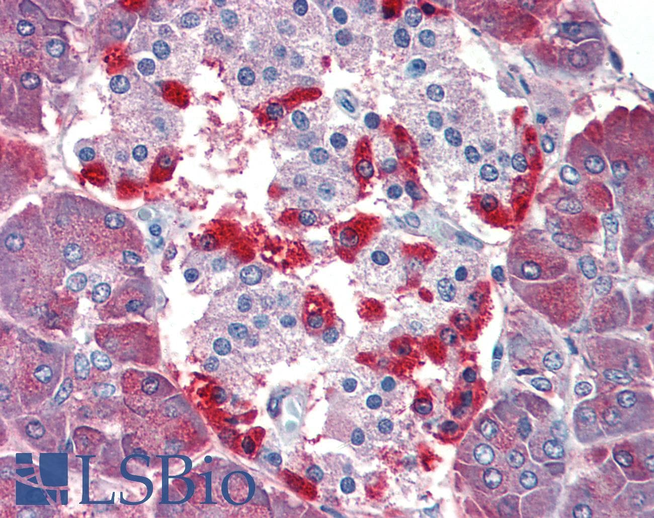 IHC-plus™ CASP4 / Caspase 4 Antibody