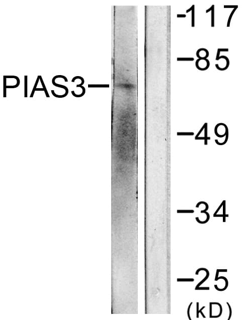 IHC-plus™ PIAS3 Antibody (aa10-59)