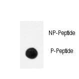 NTRK1 / TrkA Antibody (phospho-Tyr791)