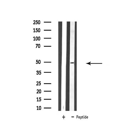 ATP6V1C2 Antibody