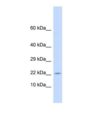 Polyclonal Rabbit anti-Human CRH / CRF Antibody (C-Terminus, IHC, WB)