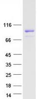 Human LZTS2 Protein (Recombinant Myc-DDK (Flag))