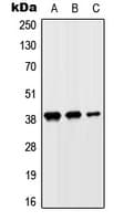 Polyclonal Rabbit anti-Human SLC10A7 Antibody (Internal, WB)