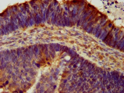 Polyclonal Rabbit anti-Human ACCN1 / ASIC2 Antibody (IHC, IF)