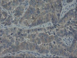 Monoclonal Mouse anti-Human COMMD1 Antibody (clone OTI1C3, IHC, WB)