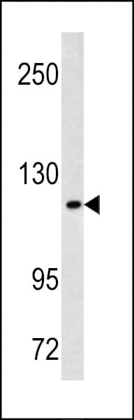 Polyclonal Rabbit anti-Human MAML3 / CAGH3 Antibody (aa640-665, IHC, WB)