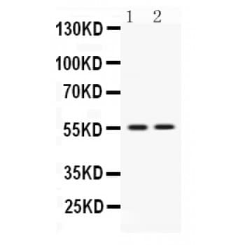 Polyclonal Rabbit anti-Human VRK1 Antibody (aa292-329, WB)