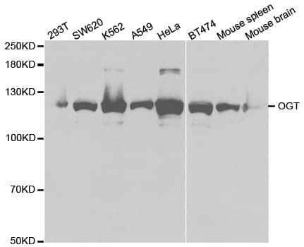 IHC-plus™ OGT / O-GLCNAC Antibody