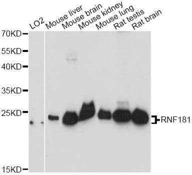 RNF181 Antibody