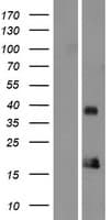 ORAOV1 Protein (Over-Expression Lysate Myc-DDK (Flag))