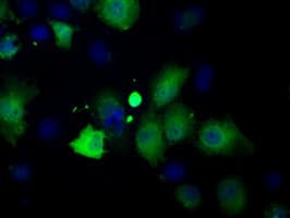 Monoclonal Mouse anti-Human PFN1 / Profilin 1 Antibody (clone OTI1D5, IHC, IF, WB)