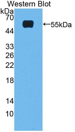 NR1H4 / FXR Antibody (aa375-568)