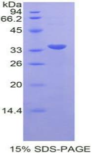 Rat STAT6 Protein (Recombinant His-T7)