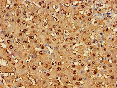 Polyclonal Rabbit anti-Human GSTA1 Antibody