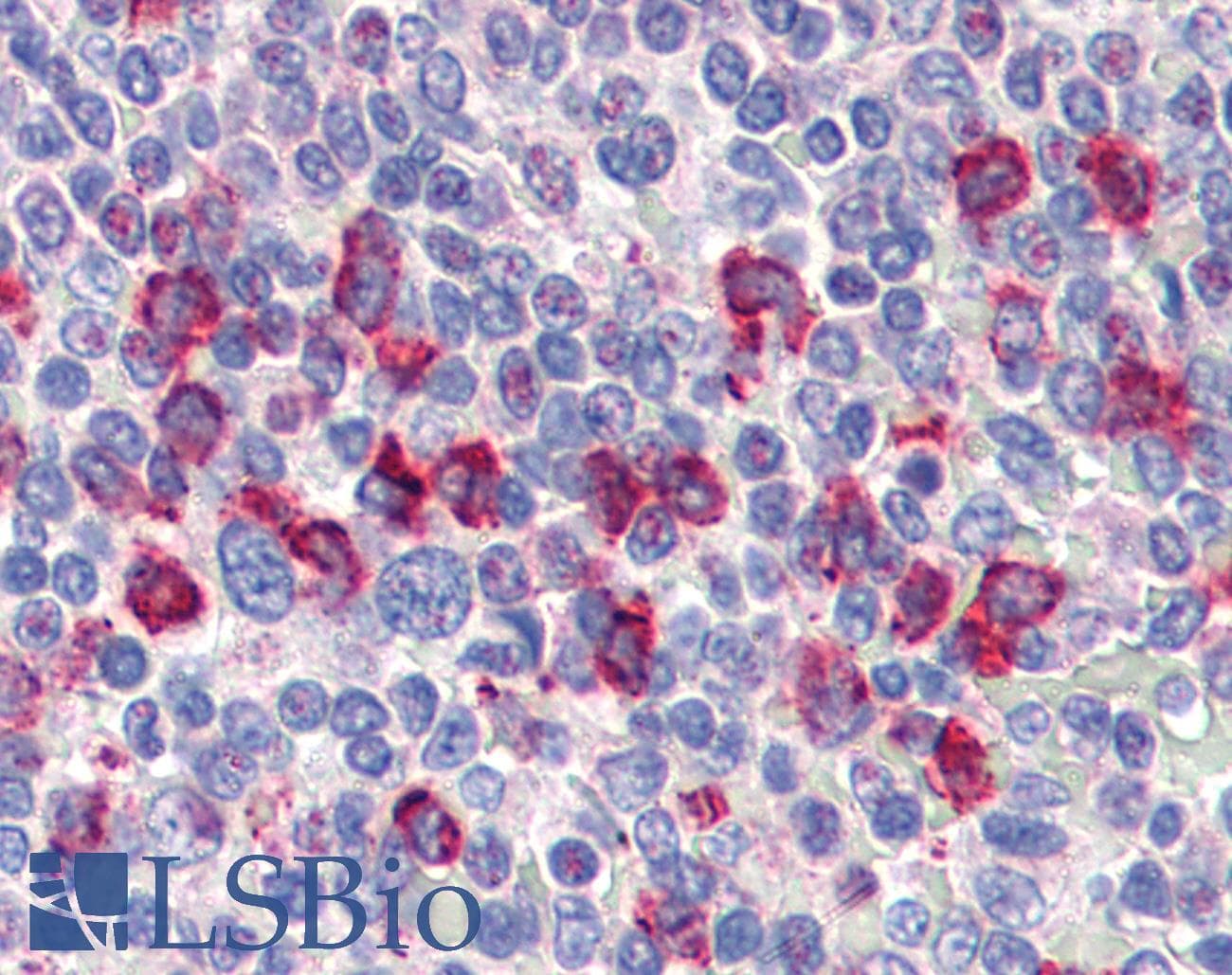 IHC-plus™ Polyclonal Goat anti-Human CD14 Antibody (aa71-84, IHC, WB)