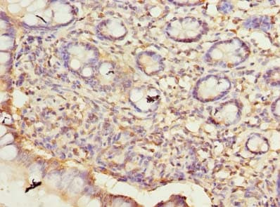 ARMCX6 Antibody