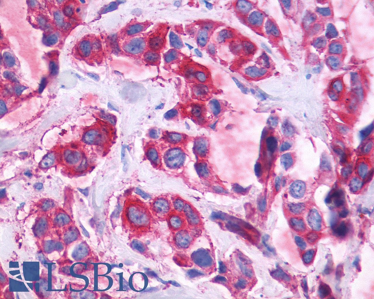 PathPlus™ Polyclonal Rabbit anti-Human ADGRF1 / GPR110 Antibody (N-Terminus, IHC)