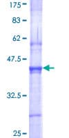 Human SENP3 Protein (Recombinant GST, N-terminus)