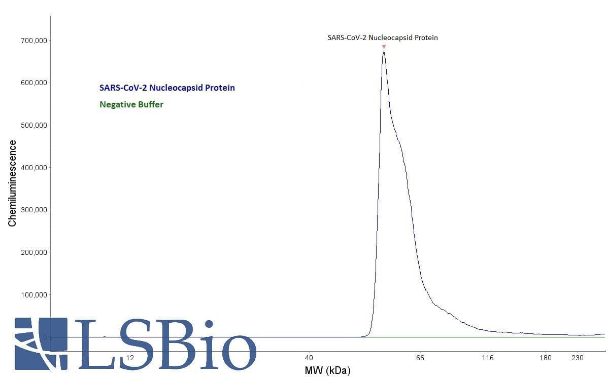 SARS-CoV-2 Nucleoprotein Antibody