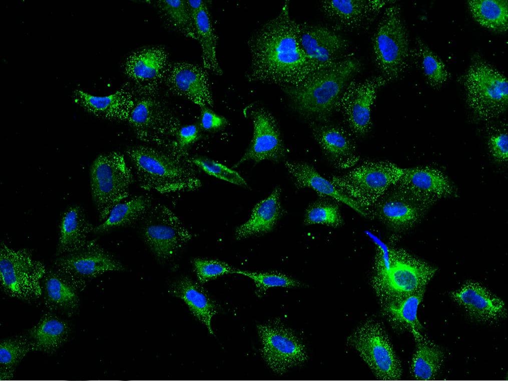 PIGK Antibody