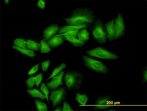 IHC-plus™ ENO3 / Enolase 3 Antibody (clone 5D1)