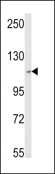 SKIV2L2 Antibody (aa237-263)