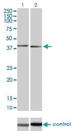 Monoclonal Mouse anti-Human MAPK11 / SAPK2 / p38 Beta Antibody (clone 1F9, WB)