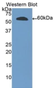 RNASET2 Antibody (aa25-256)