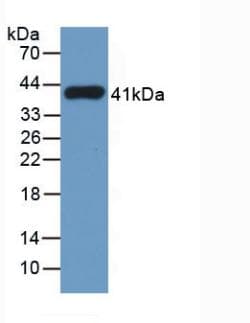 TPSAB1 / Mast Cell Tryptase Antibody (APC)