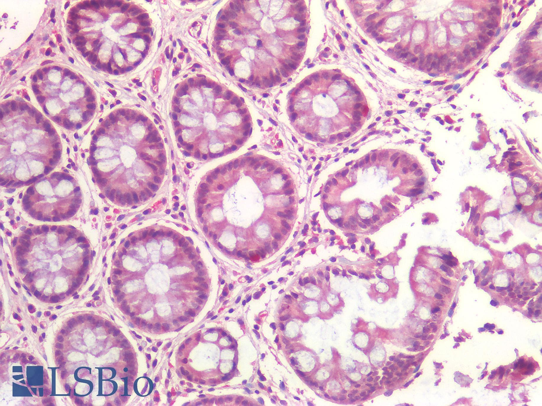 IHC-plus™ IGF1R / IGF1 Receptor Antibody