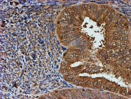 PSMB9 Antibody (aa21-219, clone OTI1D1)
