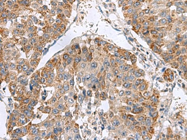 NFS1 Antibody
