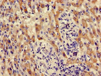ACMSD Antibody