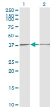 SCP2 / SCPX Antibody (clone 2E9-1B3)