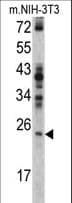 RAN Antibody (aa12-39)
