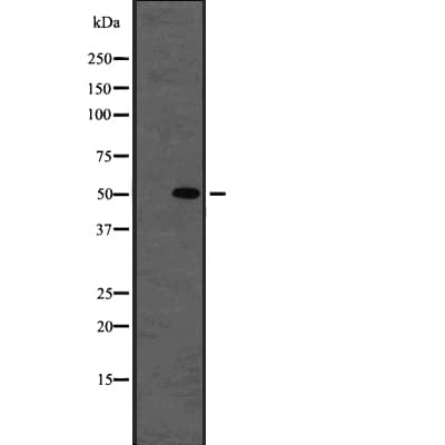 Polyclonal Rabbit anti-Human TUBB1 / Tubulin Beta 1 Antibody (IHC, IF, WB)