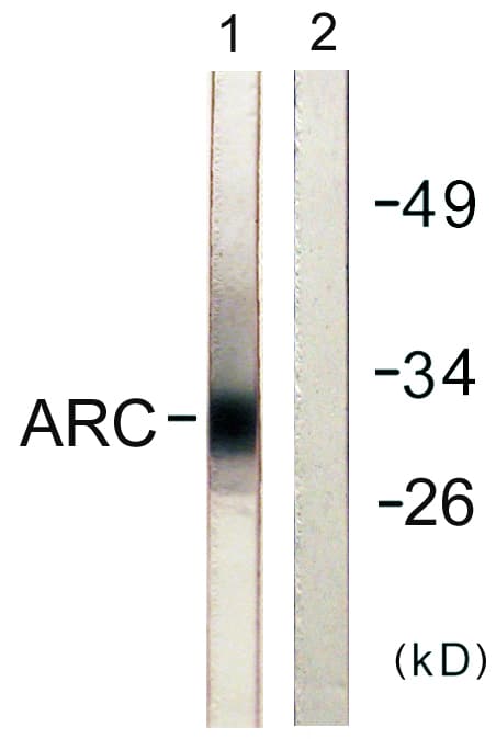 IHC-plus™ NOL3 / ARC Antibody (aa159-208)