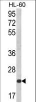 IHC-plus™ KLRC2 / NKG2C / CD159c Antibody (aa1-30)