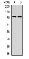 Polyclonal Rabbit anti-Human METTL3 Antibody (IHC, WB)