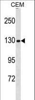 Polyclonal Rabbit anti-Human NCAPG / HCAP-G Antibody (aa117-145, WB)
