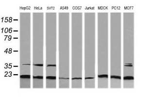 RAB30 Antibody (clone OTI3E7)