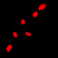 Polyclonal Rabbit anti-Human CHEK2 / CHK2 Antibody (N-Terminus, IHC, IF, WB)