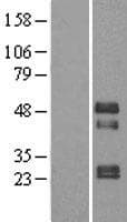 TOB2 Protein (Over-Expression Lysate Myc-DDK (Flag))