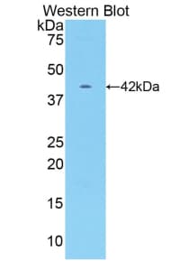 CKM / Creatine Kinase MM Antibody (aa11-367)