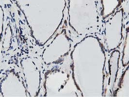 SSR1 Antibody (clone OTI4H6, Carrier-free)