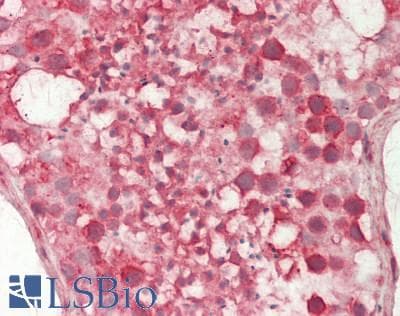 IHC-plus™ GGA1 Antibody (clone 3F11)